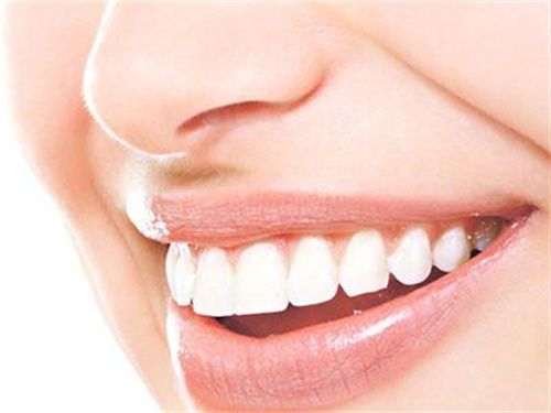杭州牙科冷光牙齿美白价格贵吗？